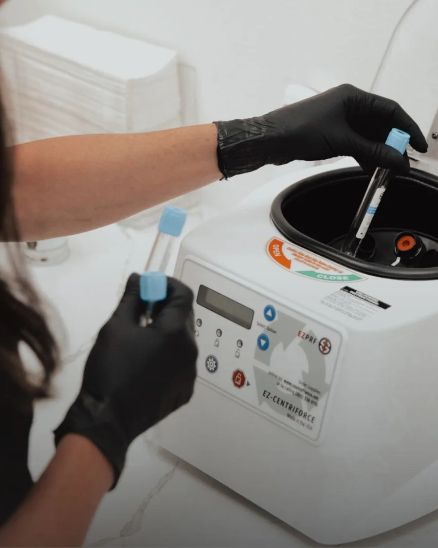 PRP Treatments at Back to 30 Med Spa