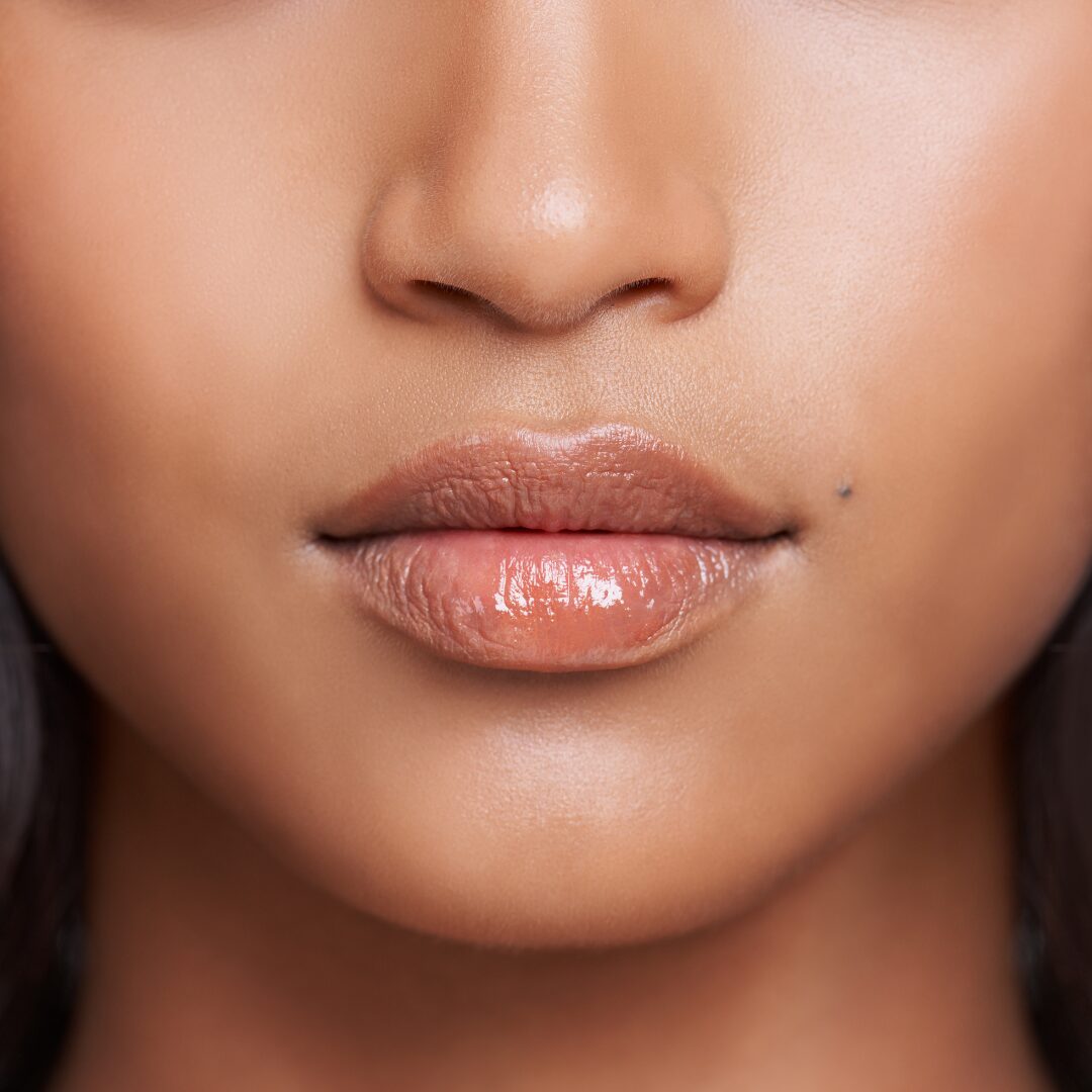 Dermal Fillers Face