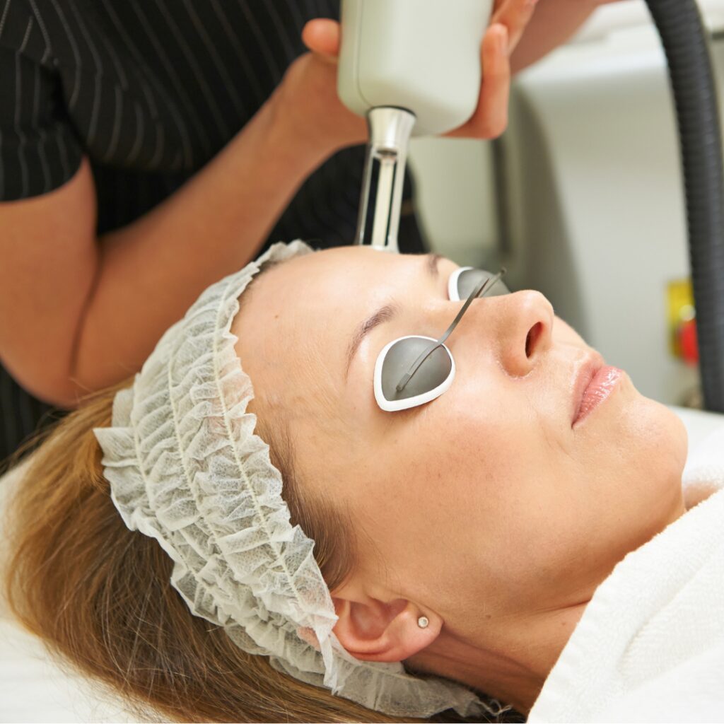 Erbium Laser Resurfacing
