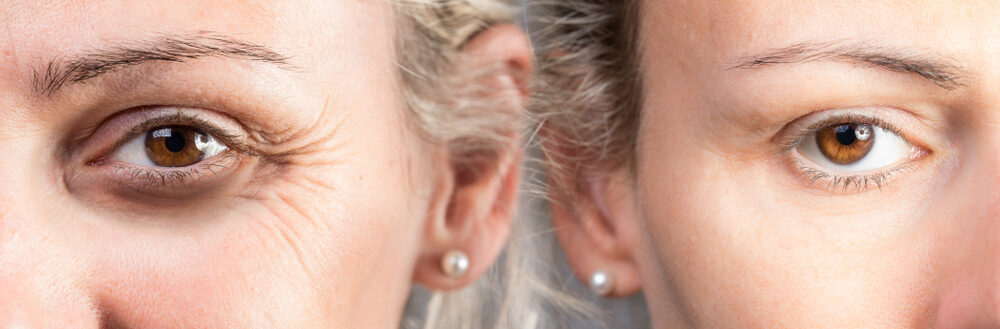 South Carolina PRF Treatments Before and After